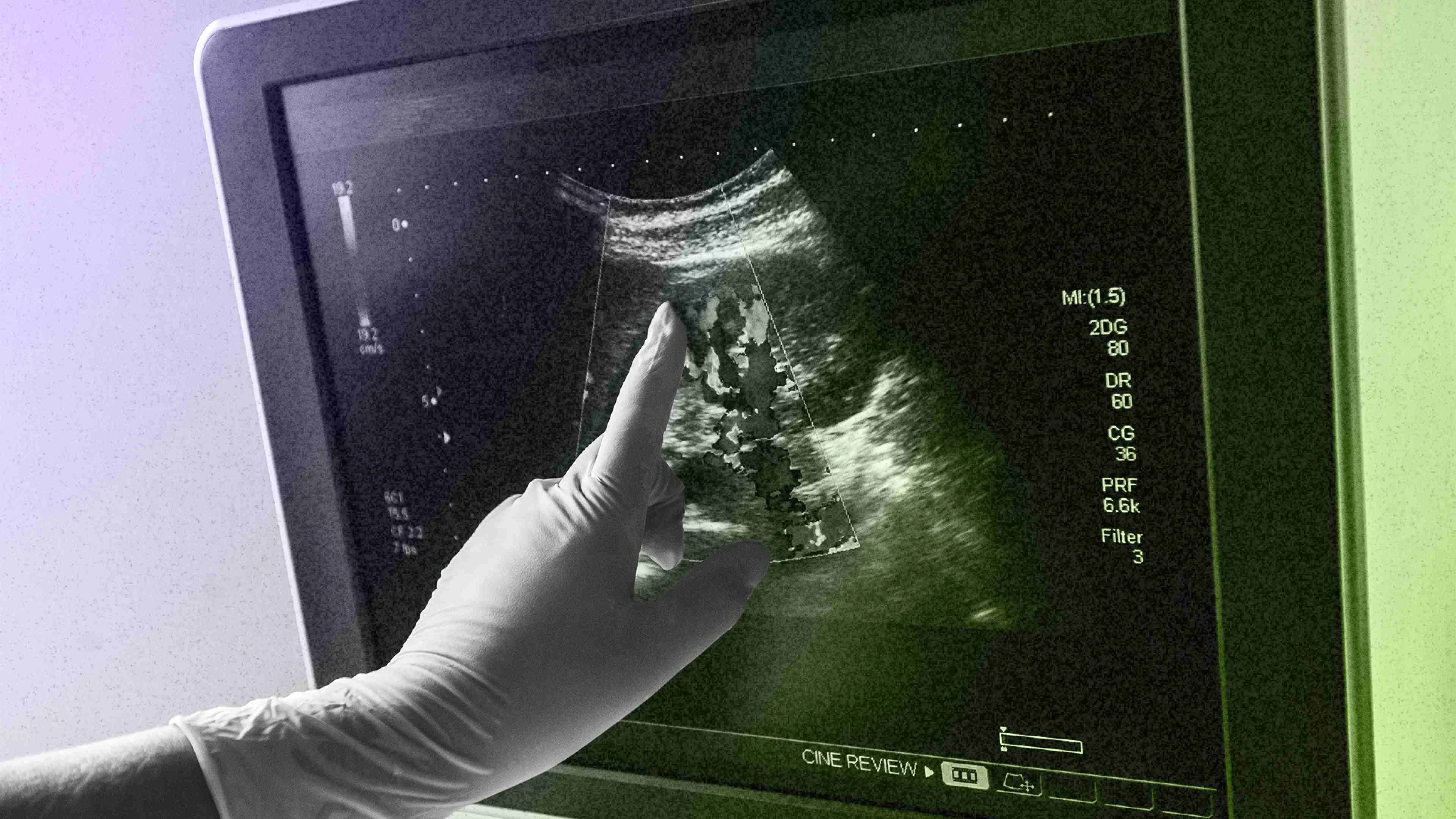 Femtech changed fertility. Now it’s ready to rebuild maternal health